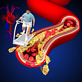 Cholesterol, illustration