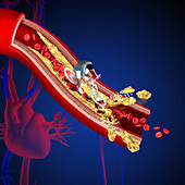 Cholesterol, illustration