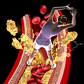 Cholesterol, illustration