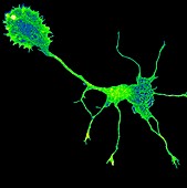 Single brain cell showing cytoskeleton, light micrograph