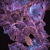 Cultured cancer cells cytoskeleton, light micrograph