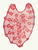 Hogweed (Heracleum) petiole, light micrograph