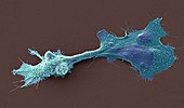 Pancreatic cancer cell, SEM