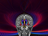 Limbic system of the brain, 3D MRI scan