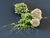 White blood cells attacking cancer cells, SEM