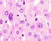 Polyploid liver cells, light micrograph