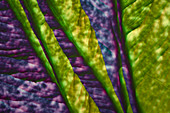 Amino acid and sulphates, polarised light micrograph
