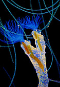Bryozoan colony, polarised light micrograph