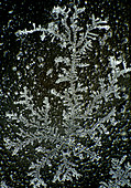 Crystallised human tear, polarised light micrograph