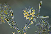 Algae, polarised light micrograph