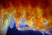 Amphipod crustacean legs, polarised light micrograph
