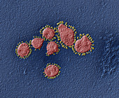 Coronavirus particles, SEM