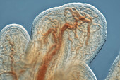 Fimbriae of a fallopian tube, light micrograph