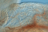 Fimbriae of a fallopian tube, light micrograph