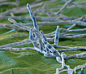 Panama disease pathogen on banana leaf, SEM
