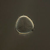 Wild cherry (Prunus avium) pollen, light micrograph