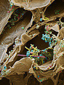 Sauerkraut bacteria, SEM