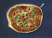 E.coli infected with T4 bacteriophages, TEM