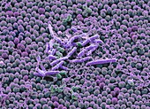 Bacteria from a human beard, SEM