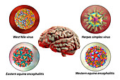 Brain infections, illustration