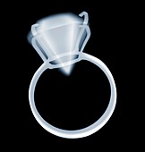 Diamond ring costume jewellery, X-ray