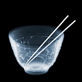 Bowl and chopsticks, X-ray