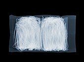 Packet of noodles, X-ray