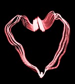 Heart ribbon cable, X-ray