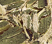 Collagen fibres, SEM