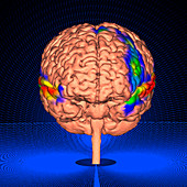Brain activity during auditory task, fMRI scan