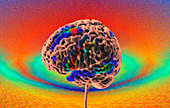 Brain activity during a visual language task, fMRI scan