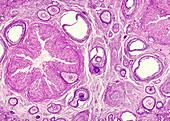 Graafian follicles in a mature ovary, light micrograph