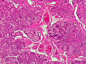 Mammalian thyroid, light micrograph
