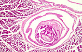 Cysticercus in pig muscle, light micrograph