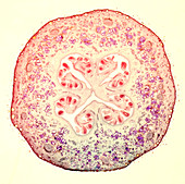 Common guava fruit cross-section, light micrograph