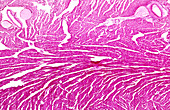 Acute pericarditis, light micrograph