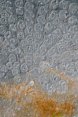 Vorticella peritrich, light micrograph