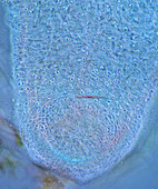 Hydra basal disk, polarised light micrograph