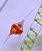 Freshwater dinoflagellate, light micrograph