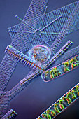 Heliozoan, diatoms and alga, light micrograph