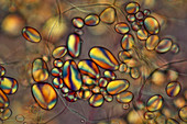 Potato starch grains, light micrograph