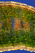 Tulip leaf, light micrograph