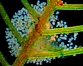 Vorticella protozoa, polarised light micrograph