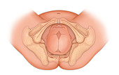 Doctor's view of posterior position delivery, illustration