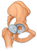 Hip anatomy, illustration