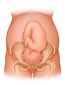 Full term pregnancy, illustration