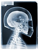Driver with driving helmet, X-ray