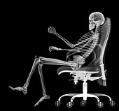 Skeleton in office chair, X-ray