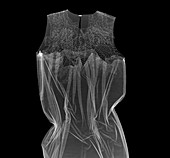Fashion dress, X-ray