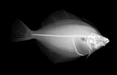 Plaice fish, X-ray